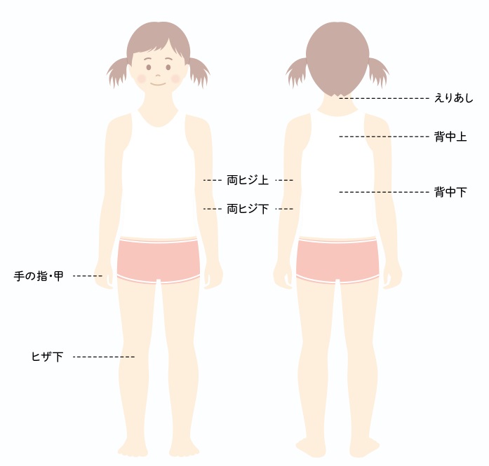 オーパスビューキッズケア　人気のケア部位